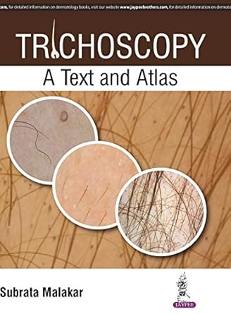 trichoscopy a text and atlas 1st edition m d malakar, subrata 9386150743, 978-9386150745