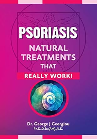 psoriasis natural treatments that really work 1st edition george john georgiou 9925569346, 978-9925569342