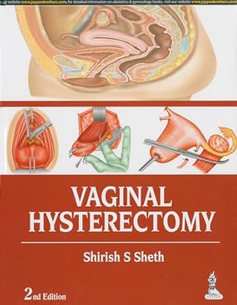 vaginal hysterectomy 1st edition m d sheth, shirish s 9351521796, 978-9351521792