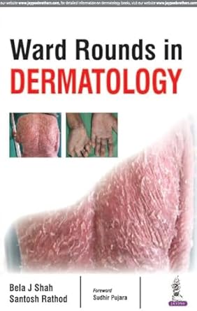 ward rounds in dermatology 1st edition m d shah, bela j ,m d rathod, santosh ,sudhir pujara 9386322684,