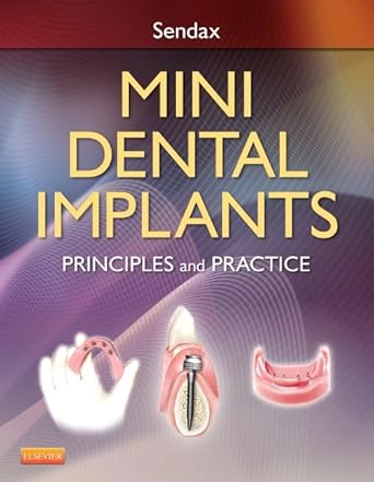 mini dental implants principles and practice 1st edition victor dr sendax 1455743860, 978-1455743865