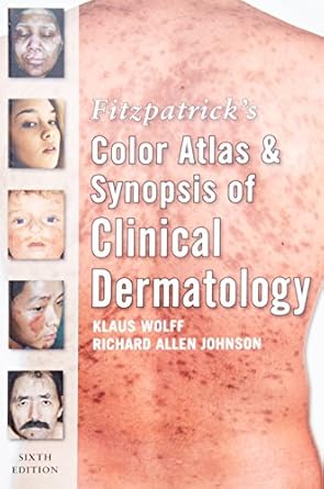 fitzpatricks color atlas and synopsis of clinical dermatology 1st edition klaus wolff ,richard johnson