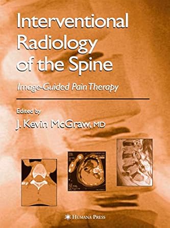 interventional radiology of the spine image guided pain therapy 1st edition j kevin mcgraw 1588291987,