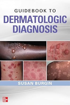 guidebook to dermatologic diagnosis 1st edition susan burgin 0071738754, 978-0071738750