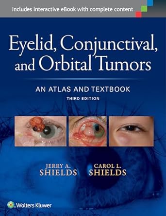 eyelid conjunctival and orbital tumors an atlas and textbook 1st edition dr jerry a shields ,dr carol l