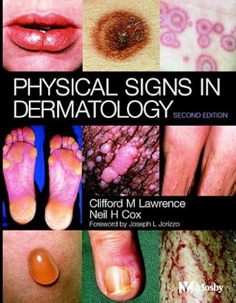 physical signs in dermatology 1st edition clifford m lawrence md frcp ,neil h cox bsc frcp 0723431841,