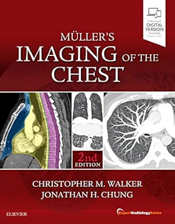 mullers imaging of the chest expert radiology series 1st edition christopher m walker md ,jonathan h chung md