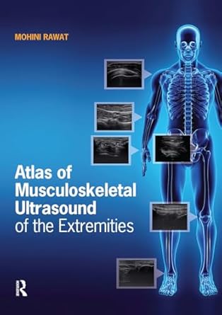 atlas of musculoskeletal ultrasound of the extremities 1st edition mohini rawat 1630916021, 978-1630916022