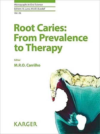 root caries from prevalence to therapy 1st edition m rocha de olivera carrilho ,a lussi ,m a r buzalaf