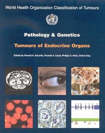 pathology and genetics of tumours of endocrine organs op 1st edition the international agency for research on
