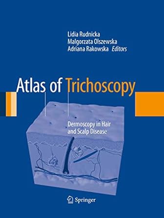 atlas of trichoscopy dermoscopy in hair and scalp disease 1st edition lidia rudnicka ,malgorzata olszewska