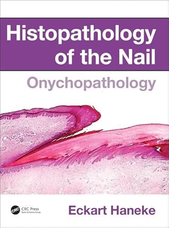 histopathology of the nail onychopathology 1st edition eckart haneke 1482212323, 978-1482212327