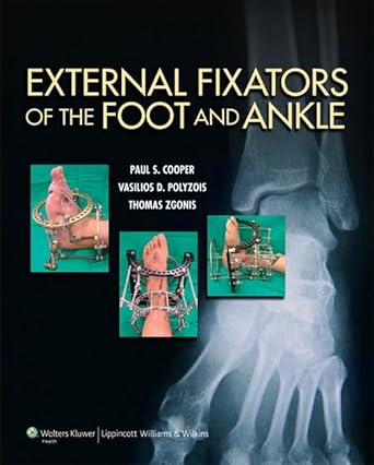 external fixators of the foot and ankle 1st edition dr paul cooper ,dr vasilios polyzois ,thomas zgonis dpm