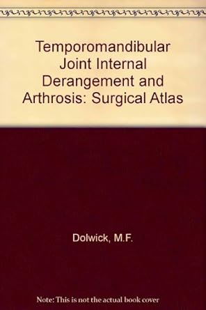 tmj internal derangement and arthrosis surgical atlas 1st edition m franklin dolwick ,bruce sanders