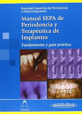 manual periodoncia y osteointegr 1st edition sepa sociedad espanola de periodoncia y osteointegracion ,jose