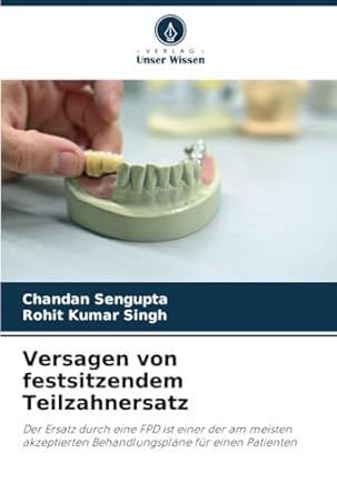 versagen von festsitzendem teilzahnersatz der ersatz durch eine fpd ist einer der am meisten akzeptierten