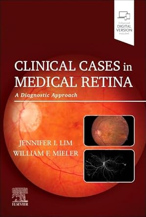 clinical cases in medical retina a diagnostic approach 1st edition jennifer i lim md ,william f mieler md