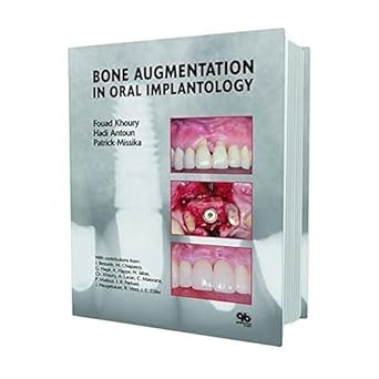bone augmentation in oral implantology 1st edition fouad khoury ,hadi antoun ,patrick missika 1850971595,