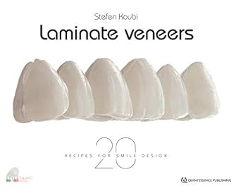 laminate veneers 20 recipes for smile design 1st edition stefen koubi 2366150555, 978-2366150551