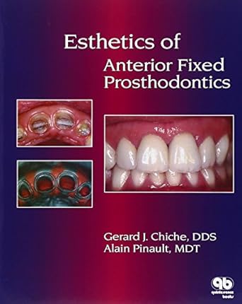 esthetics of anterior fixed prosthodontics 1st edition gerard chiche ,alain pinault 0867152583, 978-0867152586
