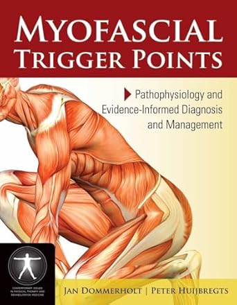 myofascial trigger points pathophysiology and evidence informed diagnosis and management pathophysiology and