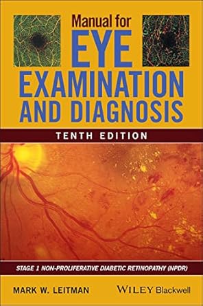 manual for eye examination and diagnosis 1st edition mark w leitman 111962858x, 978-1119628583