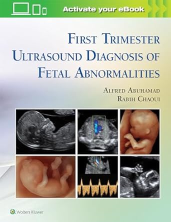 first trimester ultrasound diagnosis of fetal abnormalities 1st edition alfred z abuhamad md ,rabih chaoui md