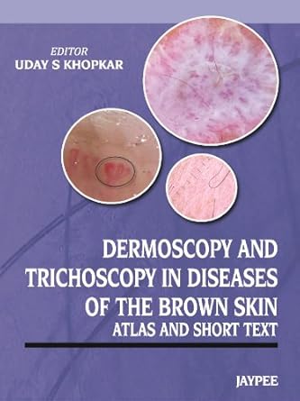 dermoscopy and trichoscopy in diseases of the brown skin atlas and short text 1st edition uday s khopkar
