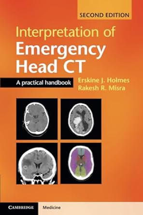 interpretation of emergency head ct a practical handbook 1st edition erskine j holmes ,rakesh r misra