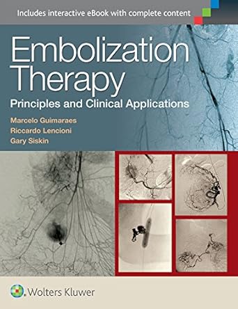 embolization therapy principles and clinical applications 1st edition marcelo guimaraes md fsir ,dr riccardo