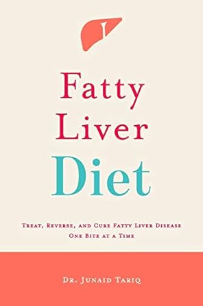 fatty liver diet treat reverse and cure fatty liver disease one bite at a time 1st edition dr junaid tariq