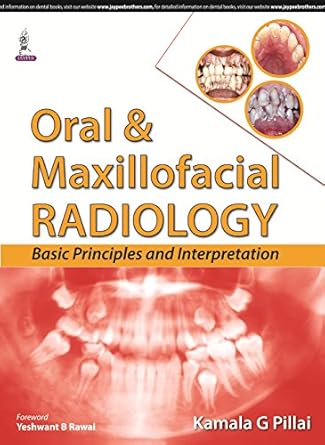 oral and maxillofacial radiology basic principles and interpretation 1st edition kamala g pillai ,yeshwant b