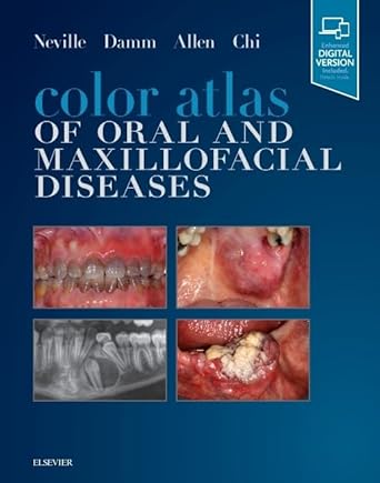 color atlas of oral and maxillofacial diseases 1st edition brad w neville dds ,douglas d damm dds ,carl m