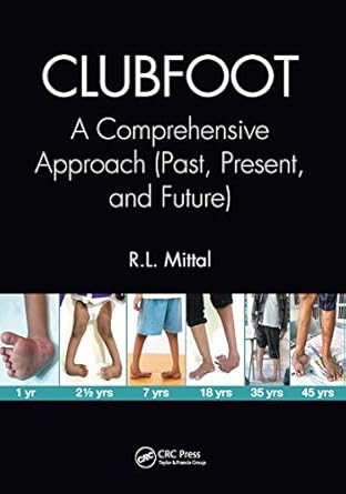clubfoot a comprehensive approach 1st edition r l mittal 0367656019, 978-0367656010