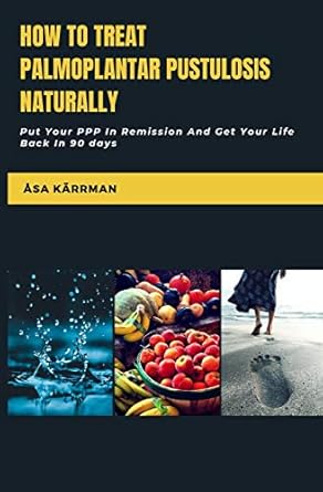 how to treat palmoplantar pustulosis naturally put your ppp in remission and get your life back 1st edition