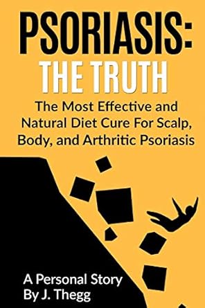 psoriasis the truth the most effective and natural diet cure for scalp body and arthritic psoriasis 1st