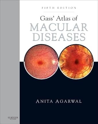 gass atlas of macular diseases 2 volume set expert consult online and print 1st edition anita agarwal md