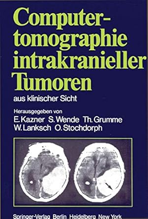 computertomographie intrakranieller tumoren aus klinischer sicht 1st edition e kazner ,hans lauterdetlev