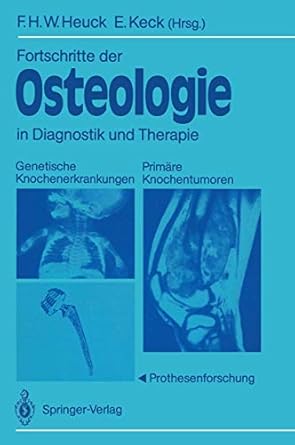 fortschritte der osteologie in diagnostik und therapie genetische knochenerkrankungen primare knochentumoren