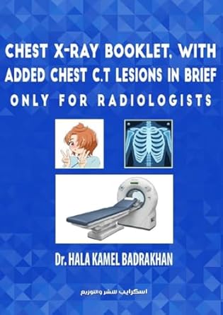 chest x ray booklet with added chest c t lesions in brief only for radiologists 1st edition dr hala kamel