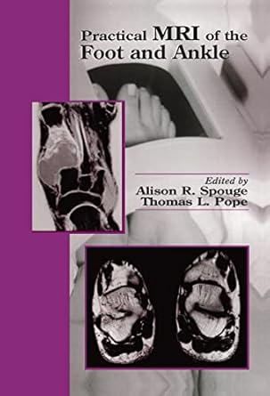 practical mri of the foot and ankle 1st edition thomas l pope ,alison r spouge 0849302811, 978-0849302817
