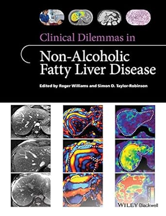 clinical dilemmas in non alcoholic fatty liver disease 1st edition roger williams ,simon d taylor robinson