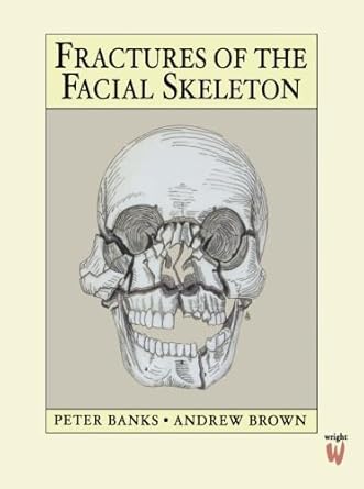 fractures of the facial skeleton 1st edition peter banks frcs fdsrcs ffdrcsi ,andrew brown frcs fdsrcs