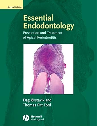 essential endodontology prevention and treatment of apical periodontitis 1st edition dag orstavik ,thomas r