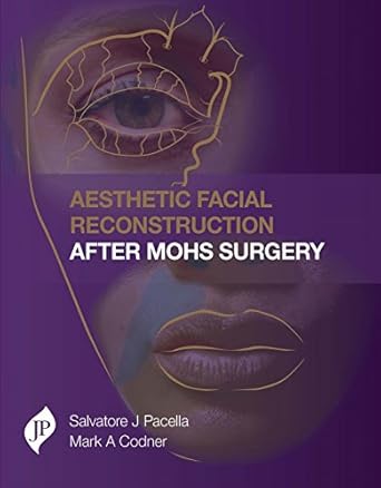 aesthetic facial reconstruction after mohs surgery 1st edition salvatore pacella ,mark a codner 1907816917,