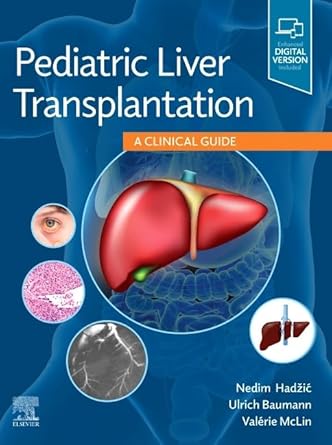 pediatric liver transplantation a clinical guide 1st edition nedim hadzic ,ulrich baumann ,valerie mclin