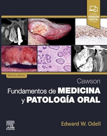 cawson fundamentos de medicina y patologia oral 1st edition edward w odell fdsrcs msc phd frcpath 8413828163,