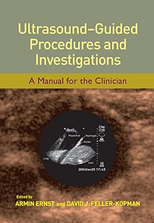 ultrasound guided procedures and investigations a manual for the clinician 1st edition armin ernst ,david