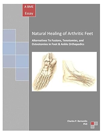natural healing of arthritic feet alternatives to fusions tenotomies and osteotomies in foot and ankle