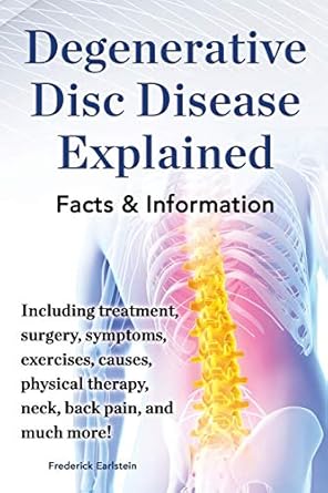 degenerative disc disease explained including treatment surgery symptoms exercises causes physical therapy
